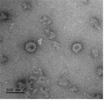 코로나19 바이러스항원(Spike)으로 구성된 바이러스유사체 투과전자현미경 (TEM) 이미지 (제공 : 질병관리본부 국립보건연구원)